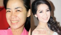 BEFORE & AFTER❤ ❤❤ ❤   - SUPER 1 Make UP