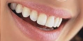 ฟันขาว สวย